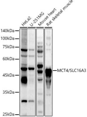 Western Blot: SLC16A3 Antibody [NBP2-94186] - Western blot analysis of extracts of various cell lines, using SLC16A3 antibody (NBP2-94186) at 1:1000 dilution. Secondary antibody: HRP Goat Anti-Rabbit IgG (H+L) at 1:10000 dilution. Lysates/proteins: 25ug per lane. Blocking buffer: 3% nonfat dry milk in TBST. Detection: ECL Basic Kit. Exposure time: 30s.